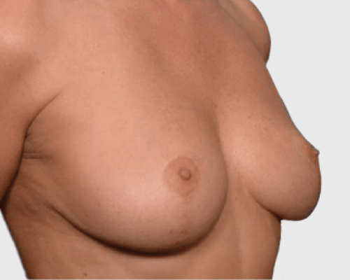 beforeafter8
